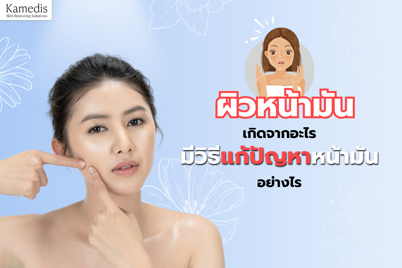 อะไรคือสาเหตุที่ทำให้หน้ามัน มีวิธีแก้ปัญหานี้อย่างไร