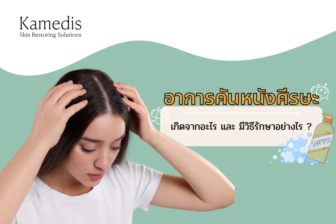 อาการคันหนังศีรษะ ปัญหากวนใจนี้เกิดจากอะไรและแก้ได้ด้วยวิธีใดบ้าง?