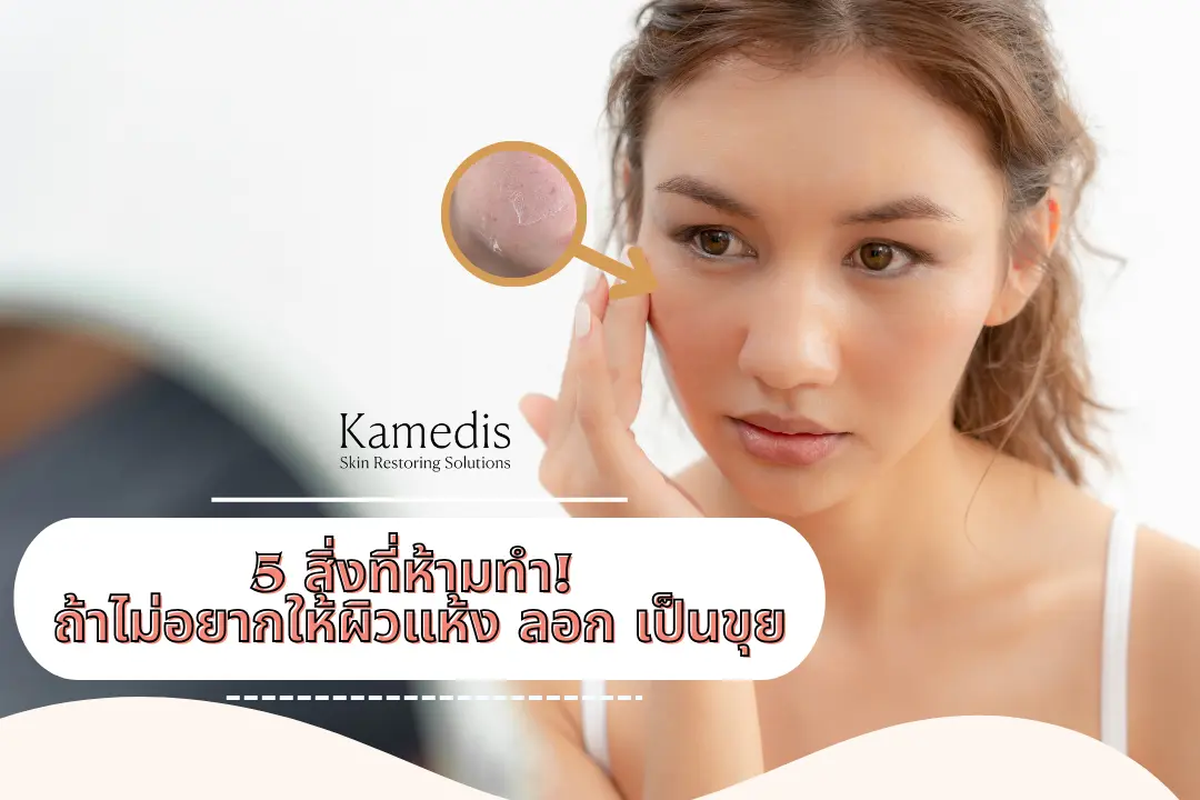 5 สิ่งที่ห้ามทำ! ถ้าไม่อยากให้ผิวแห้ง ลอก เป็นขุย