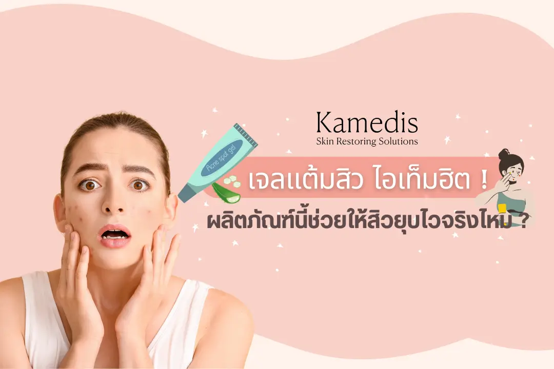เจลแต้มสิว ไอเท็มฮิต ! ช่วยให้สิวยุบไวจริงไหม ?