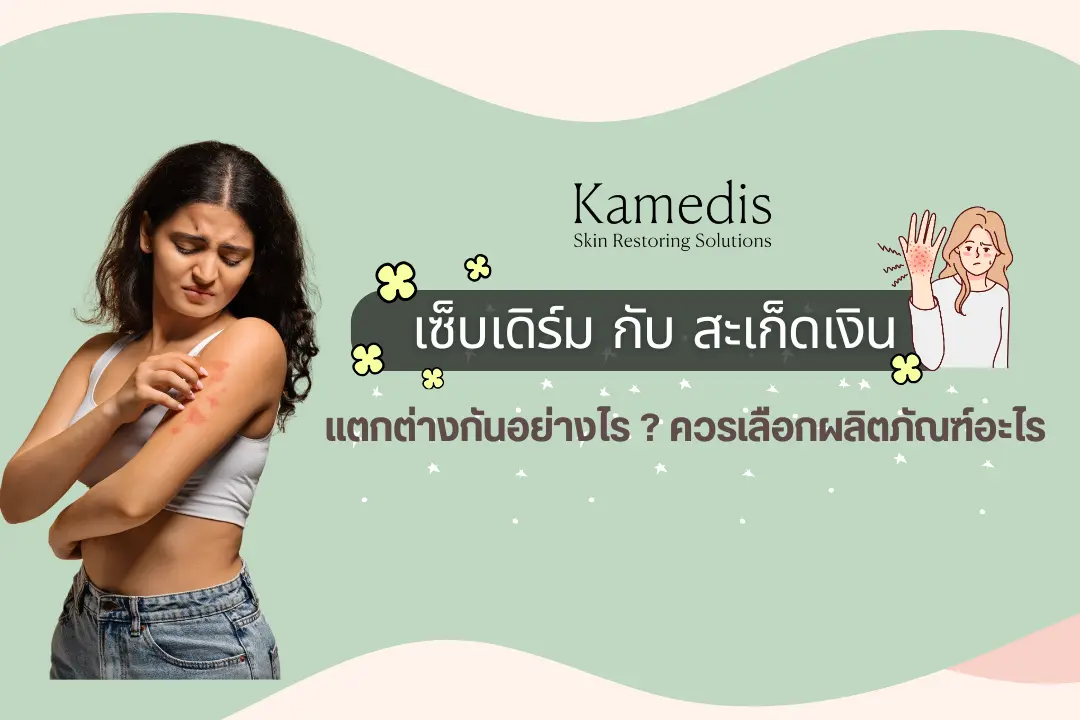 เซ็บเดิร์ม กับ สะเก็ดเงิน มีความแตกต่างกันอย่างไร ? ควรเลือกใช้ผลิตภัณฑ์อะไร